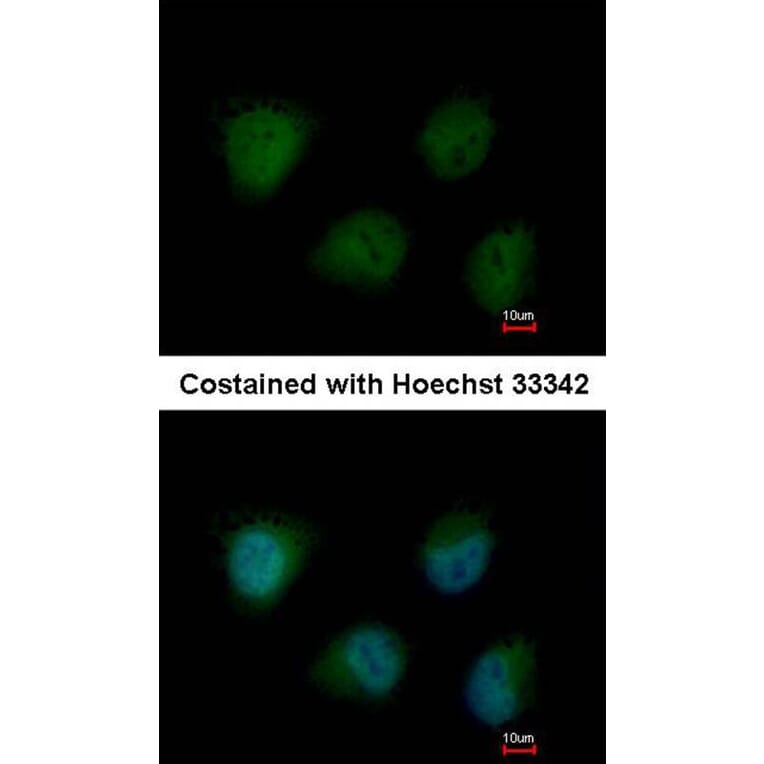 Immunofluorescence - O-GlcNAc transferase antibody from Signalway Antibody (22476) - Antibodies.com