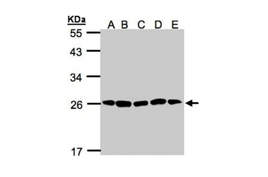 20S Proteasome alpha2 antibody from Signalway Antibody (22606) - Antibodies.com