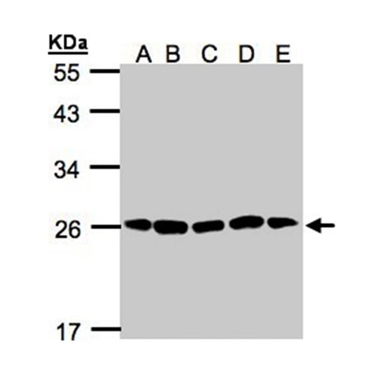 20S Proteasome alpha2 antibody from Signalway Antibody (22606) - Antibodies.com