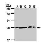 20S Proteasome alpha2 antibody from Signalway Antibody (22606) - Antibodies.com