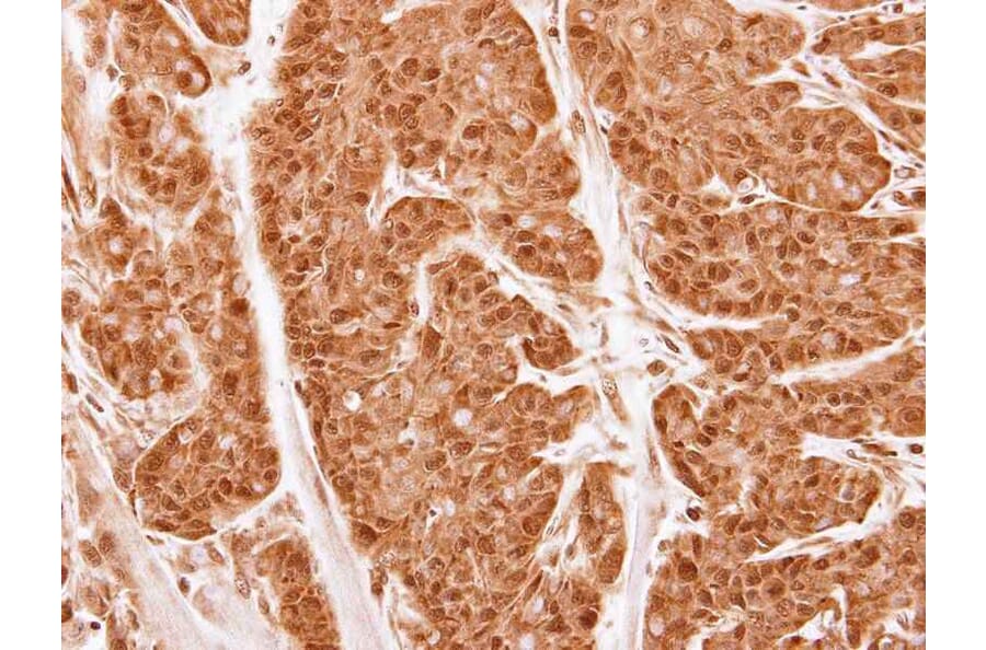 Immunohistochemistry - 20S Proteasome alpha2 antibody from Signalway Antibody (22606) - Antibodies.com