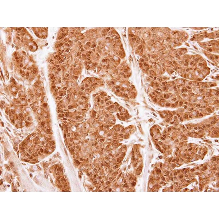 Immunohistochemistry - 20S Proteasome alpha2 antibody from Signalway Antibody (22606) - Antibodies.com