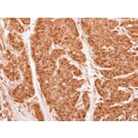 Immunohistochemistry - 20S Proteasome alpha2 antibody from Signalway Antibody (22606) - Antibodies.com