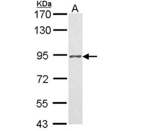 Progesterone receptor antibody from Signalway Antibody (23053) - Antibodies.com