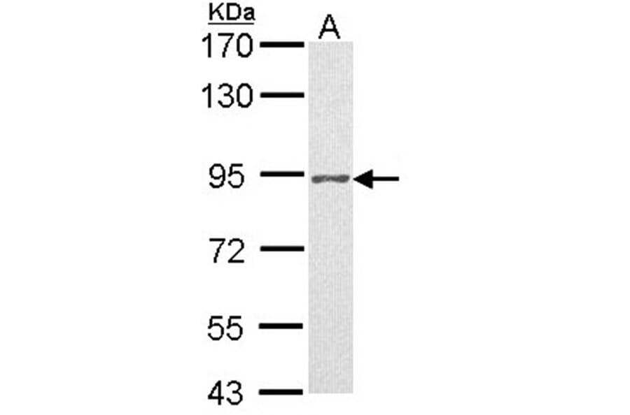 Progesterone receptor antibody from Signalway Antibody (23053) - Antibodies.com