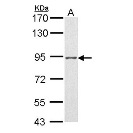 Progesterone receptor antibody from Signalway Antibody (23053) - Antibodies.com