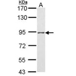 Progesterone receptor antibody from Signalway Antibody (23053) - Antibodies.com