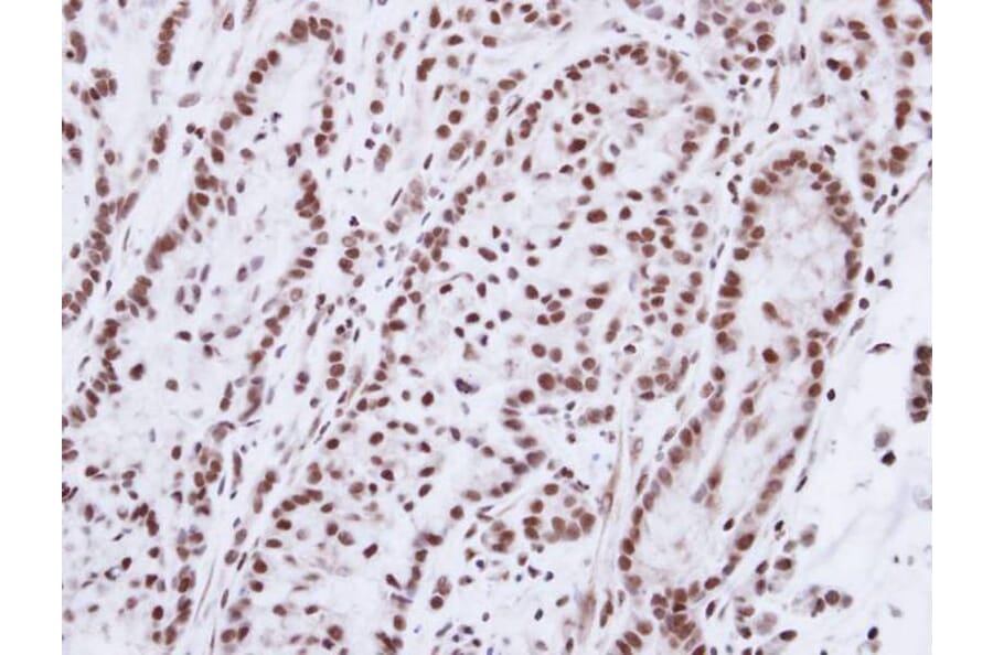 Immunohistochemistry - Progesterone receptor antibody from Signalway Antibody (23053) - Antibodies.com
