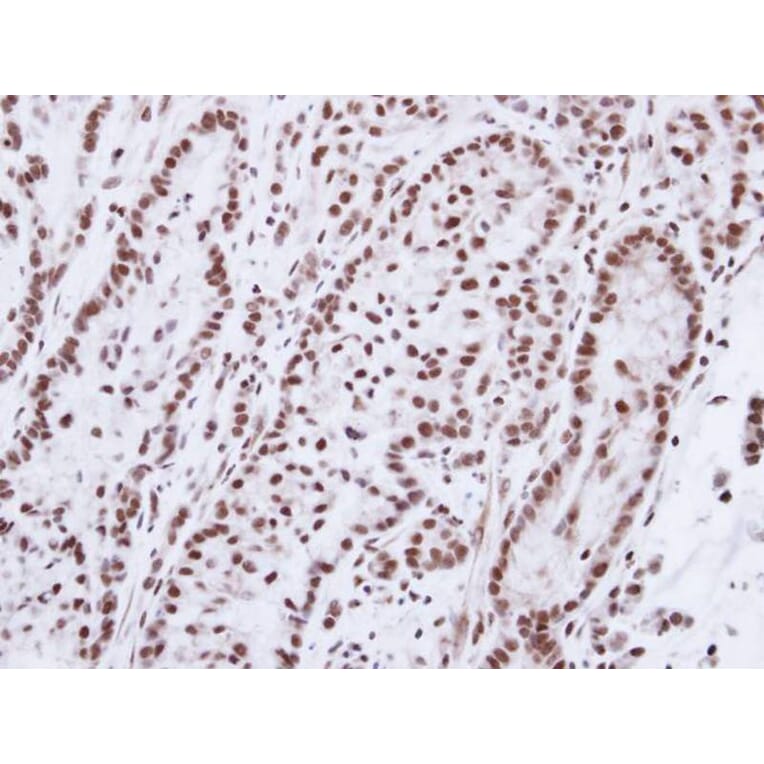 Immunohistochemistry - Progesterone receptor antibody from Signalway Antibody (23053) - Antibodies.com