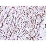 Immunohistochemistry - Progesterone receptor antibody from Signalway Antibody (23053) - Antibodies.com