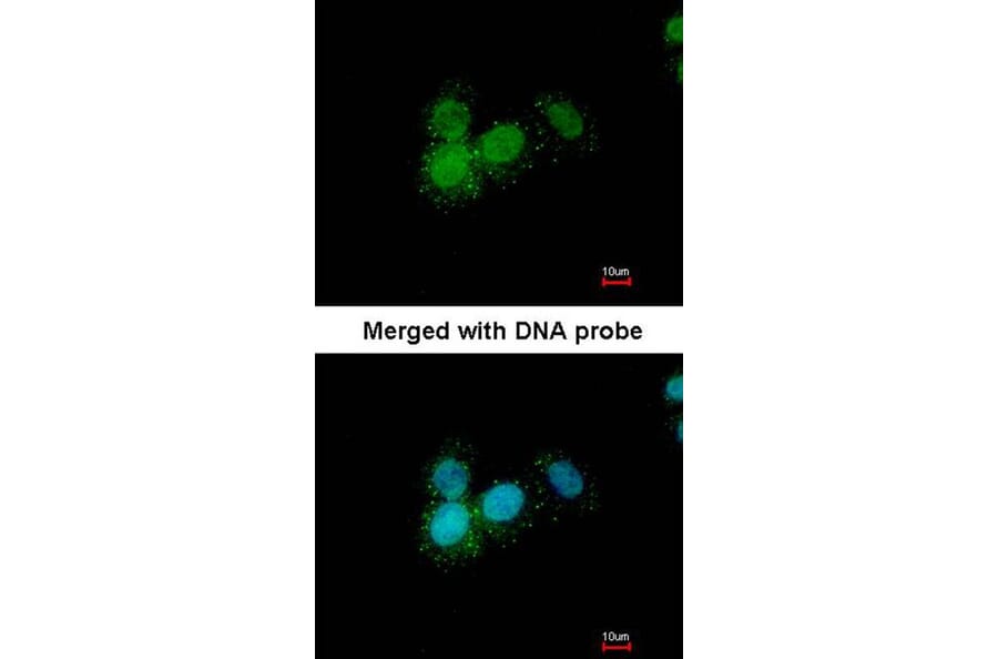 Immunofluorescence - Progesterone receptor antibody from Signalway Antibody (23053) - Antibodies.com