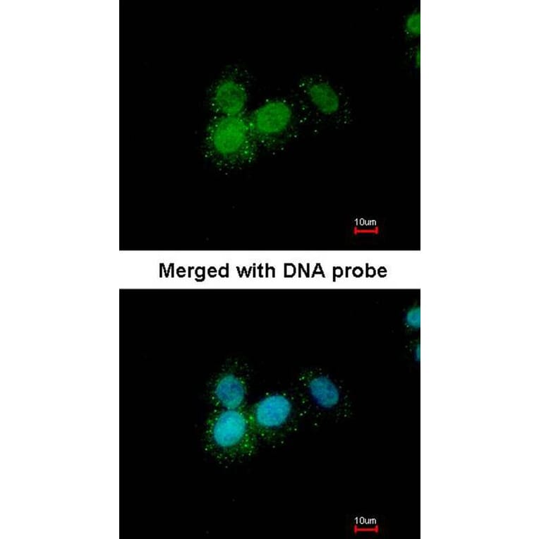 Immunofluorescence - Progesterone receptor antibody from Signalway Antibody (23053) - Antibodies.com