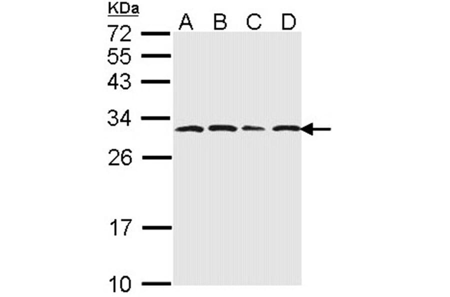 20S Proteasome alpha6 antibody from Signalway Antibody (23060) - Antibodies.com