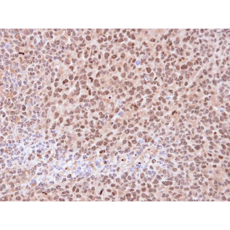 Immunohistochemistry - 20S Proteasome alpha6 antibody from Signalway Antibody (23060) - Antibodies.com