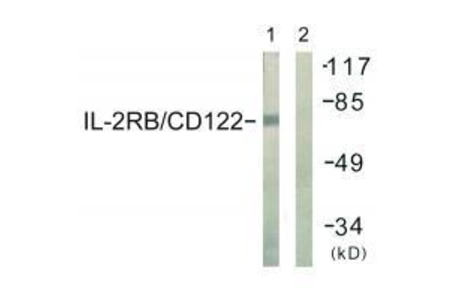 Western blot - IL-2Rβ/CD122 (Ab-364) Antibody from Signalway Antibody (33168) - Antibodies.com