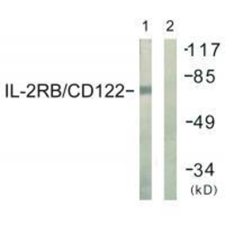 Western blot - IL-2Rβ/CD122 (Ab-364) Antibody from Signalway Antibody (33168) - Antibodies.com