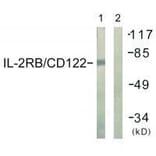Western blot - IL-2Rβ/CD122 (Ab-364) Antibody from Signalway Antibody (33168) - Antibodies.com
