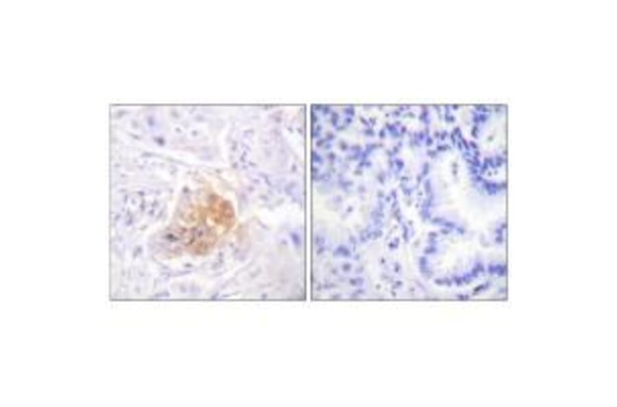 Immunohistochemistry - IL-2Rβ/CD122 (Ab-364) Antibody from Signalway Antibody (33168) - Antibodies.com