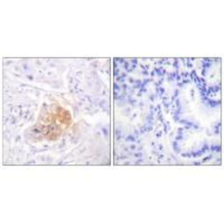 Immunohistochemistry - IL-2Rβ/CD122 (Ab-364) Antibody from Signalway Antibody (33168) - Antibodies.com