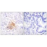 Immunohistochemistry - IL-2Rβ/CD122 (Ab-364) Antibody from Signalway Antibody (33168) - Antibodies.com