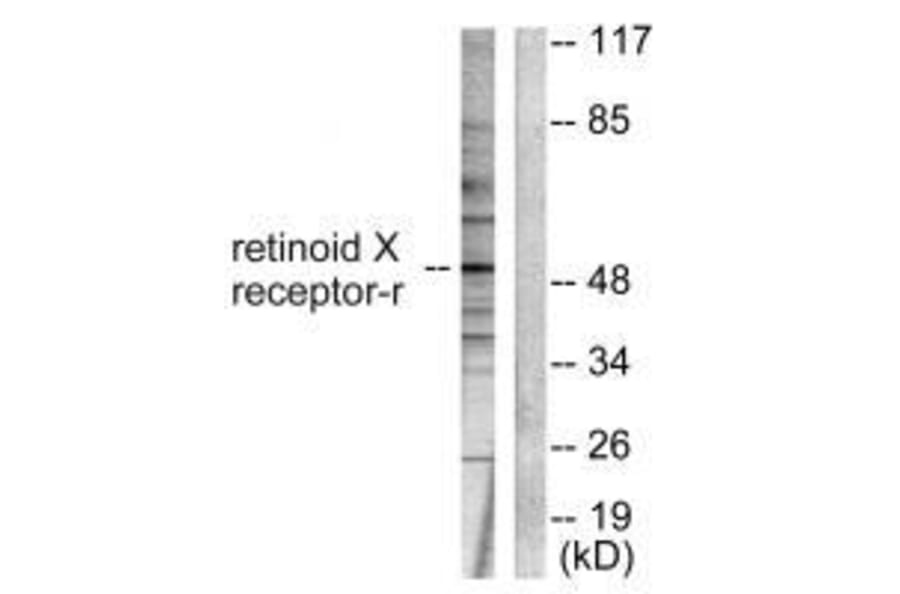 Western blot - Retinoid X Receptor γ Antibody from Signalway Antibody (33481) - Antibodies.com