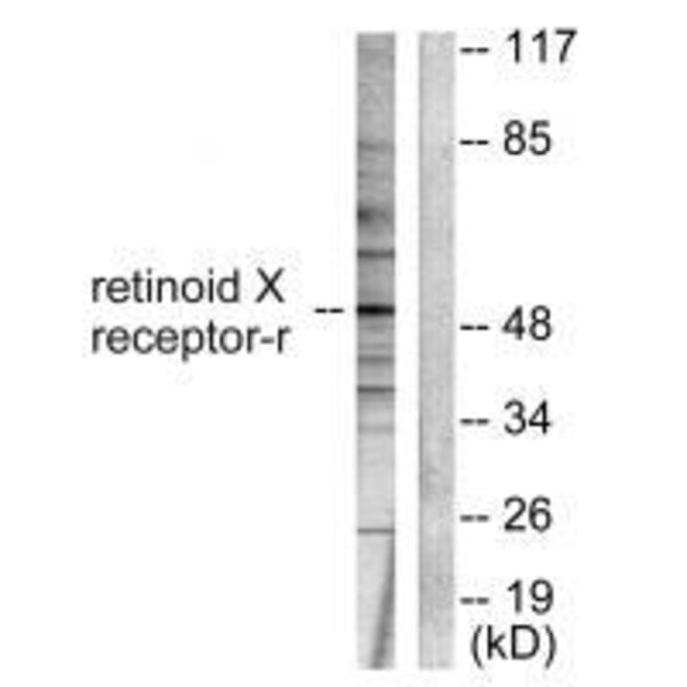 Western blot - Retinoid X Receptor γ Antibody from Signalway Antibody (33481) - Antibodies.com