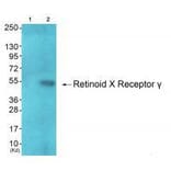 Western blot - Retinoid X Receptor γ Antibody from Signalway Antibody (33481) - Antibodies.com