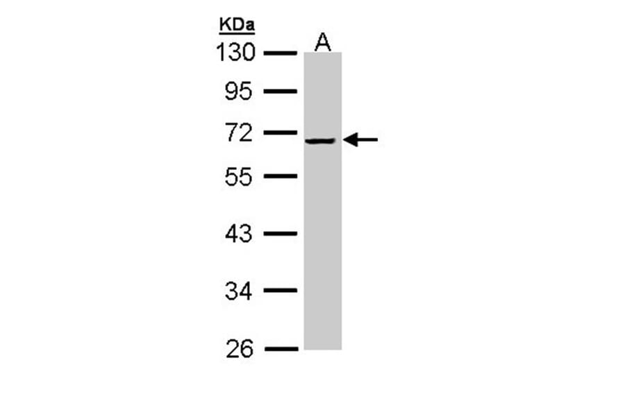 alpha-2 antiplasmin antibody from Signalway Antibody (22561) - Antibodies.com
