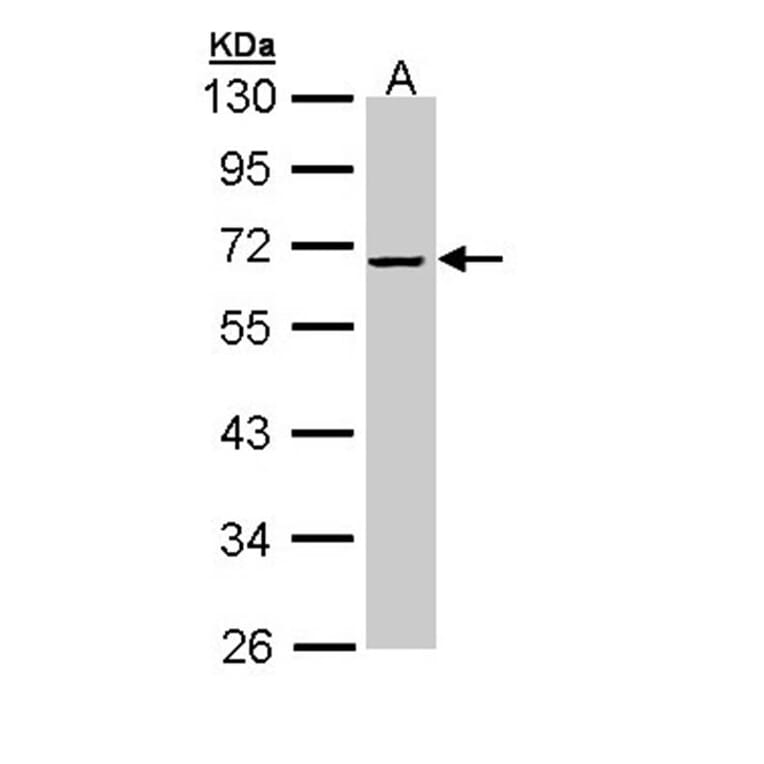 alpha-2 antiplasmin antibody from Signalway Antibody (22561) - Antibodies.com