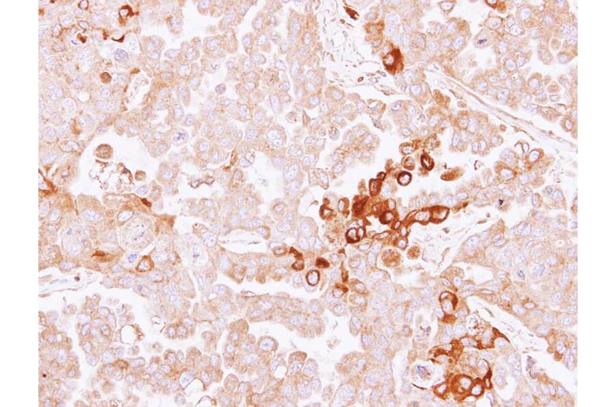 Immunohistochemistry - alpha-2 antiplasmin antibody from Signalway Antibody (22561) - Antibodies.com