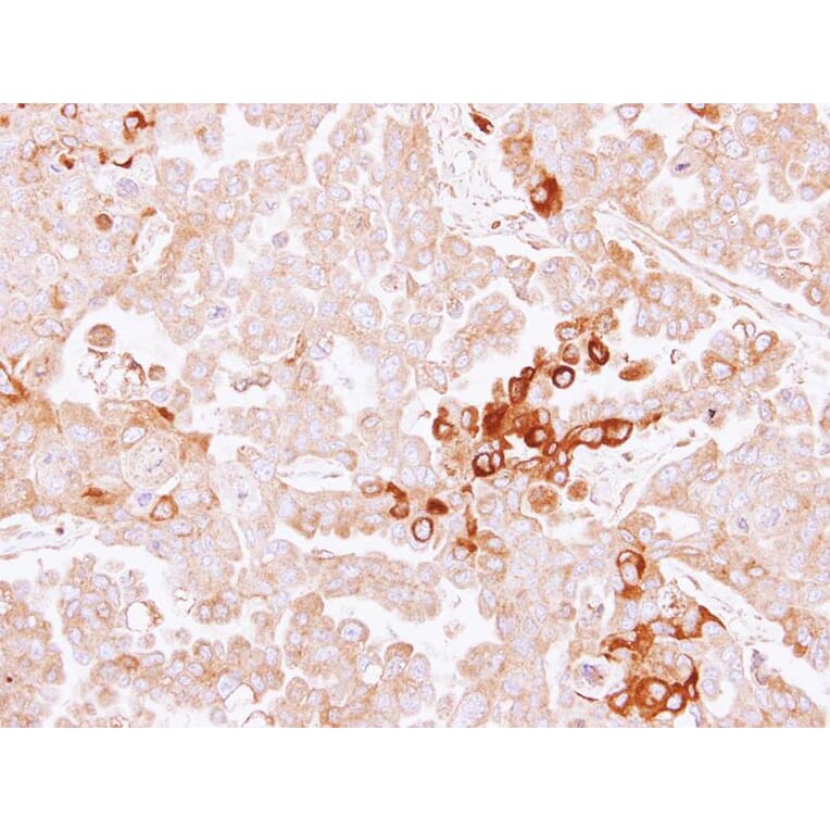 Immunohistochemistry - alpha-2 antiplasmin antibody from Signalway Antibody (22561) - Antibodies.com