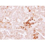 Immunohistochemistry - alpha-2 antiplasmin antibody from Signalway Antibody (22561) - Antibodies.com