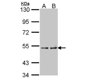 Cytochrome P450 4A11 antibody from Signalway Antibody (22646) - Antibodies.com