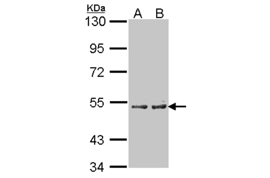 Cytochrome P450 4A11 antibody from Signalway Antibody (22646) - Antibodies.com