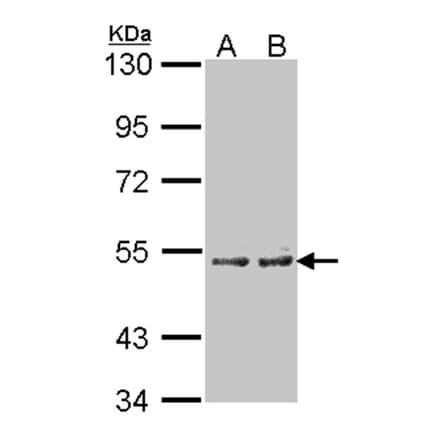 Cytochrome P450 4A11 antibody from Signalway Antibody (22646) - Antibodies.com