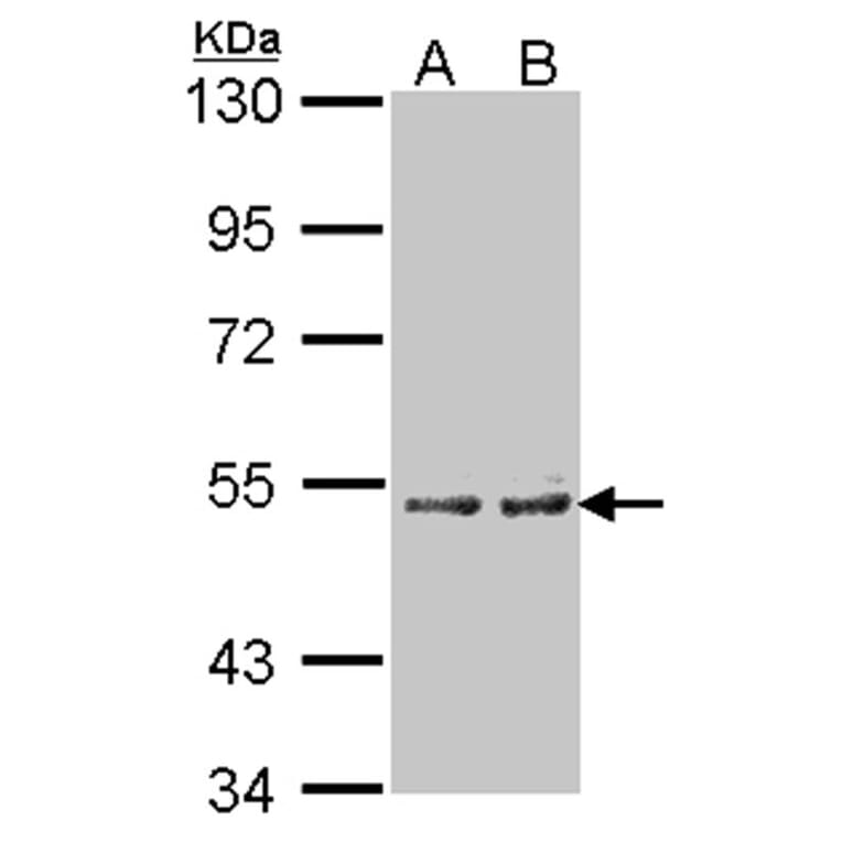Cytochrome P450 4A11 antibody from Signalway Antibody (22646) - Antibodies.com
