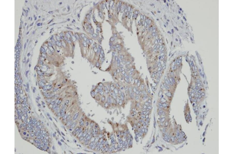 Immunohistochemistry - Cytochrome P450 4A11 antibody from Signalway Antibody (22646) - Antibodies.com