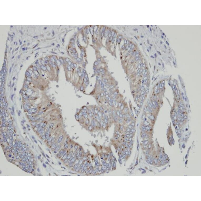 Immunohistochemistry - Cytochrome P450 4A11 antibody from Signalway Antibody (22646) - Antibodies.com