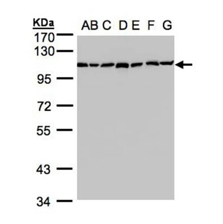alpha Glucosidase II antibody from Signalway Antibody (22651) - Antibodies.com