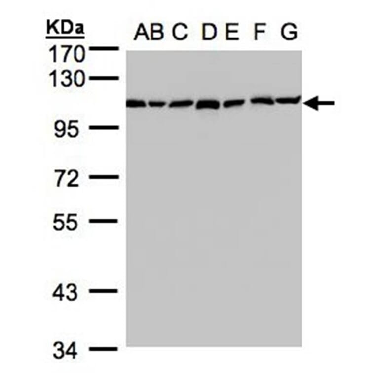 alpha Glucosidase II antibody from Signalway Antibody (22651) - Antibodies.com