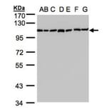 alpha Glucosidase II antibody from Signalway Antibody (22651) - Antibodies.com