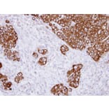 Immunohistochemistry - alpha Glucosidase II antibody from Signalway Antibody (22651) - Antibodies.com