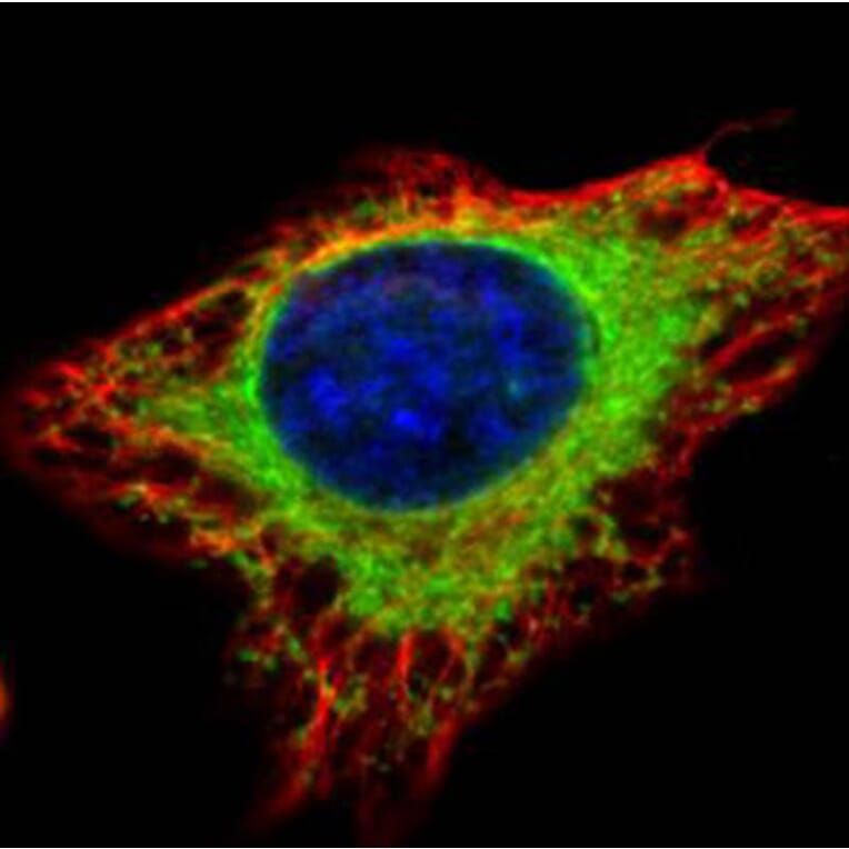 alpha Glucosidase II antibody from Signalway Antibody (22651) - Antibodies.com