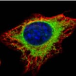 alpha Glucosidase II antibody from Signalway Antibody (22651) - Antibodies.com