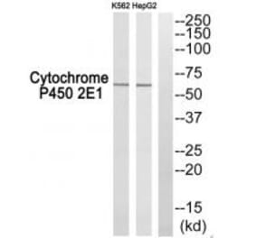 Western blot - Cytochrome P450 2E1 Antibody from Signalway Antibody (34238) - Antibodies.com