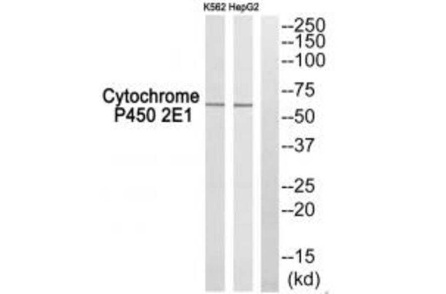 Western blot - Cytochrome P450 2E1 Antibody from Signalway Antibody (34238) - Antibodies.com