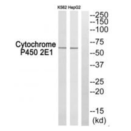 Western blot - Cytochrome P450 2E1 Antibody from Signalway Antibody (34238) - Antibodies.com