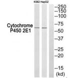 Western blot - Cytochrome P450 2E1 Antibody from Signalway Antibody (34238) - Antibodies.com