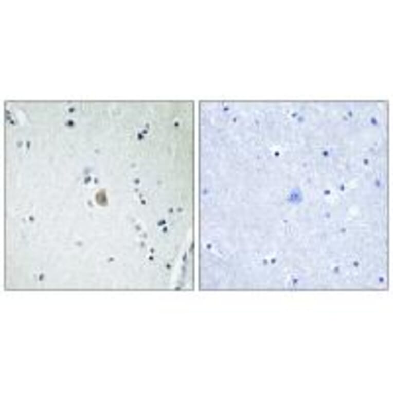 Immunohistochemistry - Cytochrome P450 2E1 Antibody from Signalway Antibody (34238) - Antibodies.com