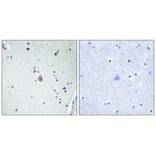 Immunohistochemistry - Cytochrome P450 2E1 Antibody from Signalway Antibody (34238) - Antibodies.com